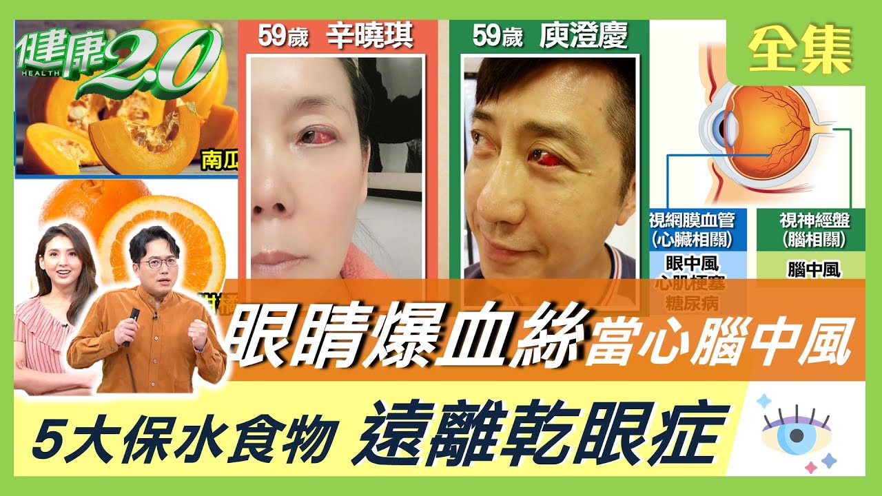 眼睛爆血絲 眼睛乾澀 當心腦中風 自體免疫疾病！護眼5大保水食物 遠離乾眼症 健康2.0 20210911 (完整版)