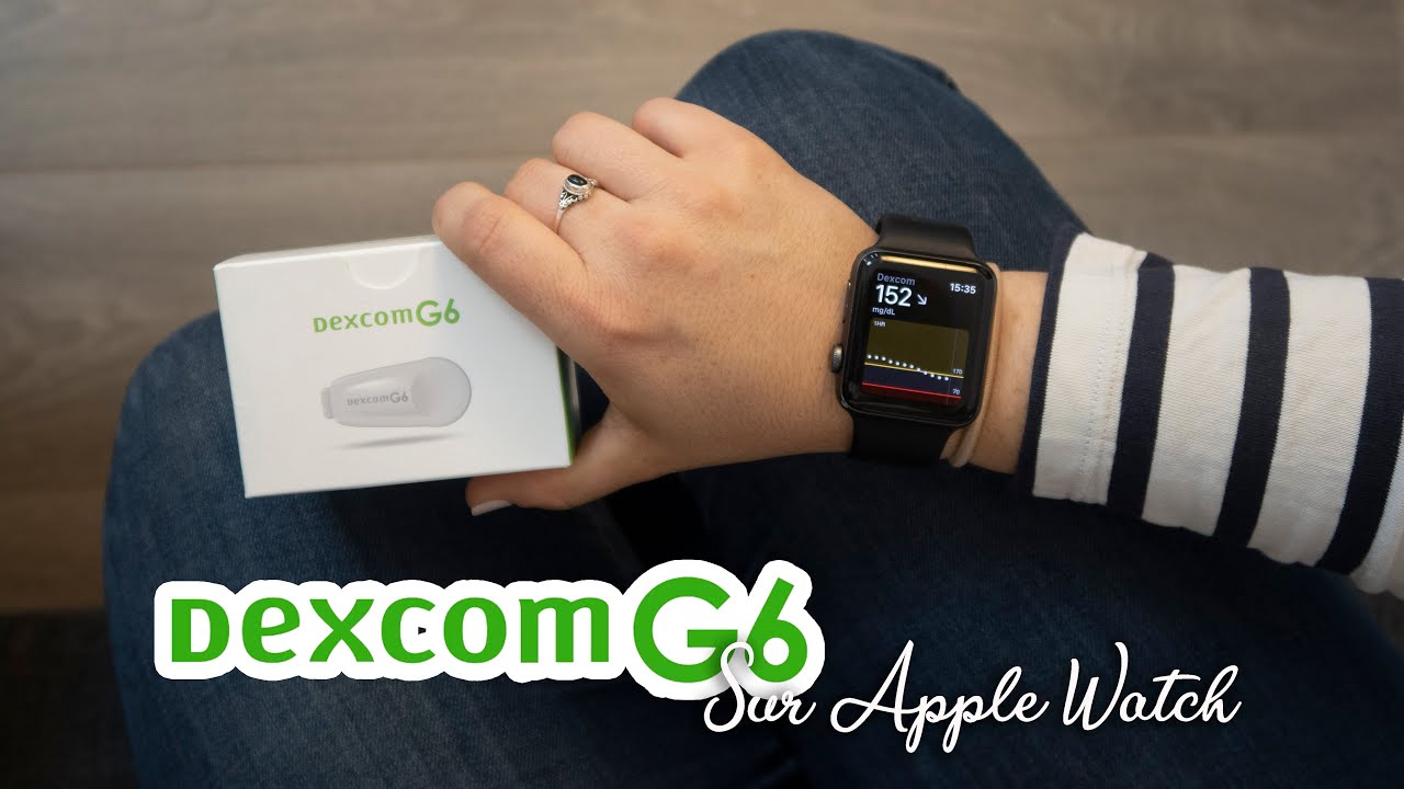 Dexcom G6 sur Apple Watch ⌚️