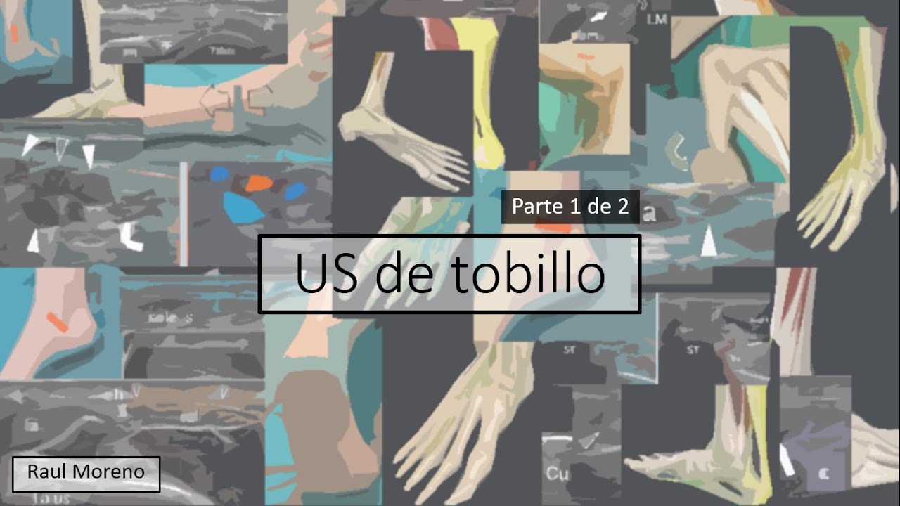Ultrasonido de tobillo paso por paso (parte 1)