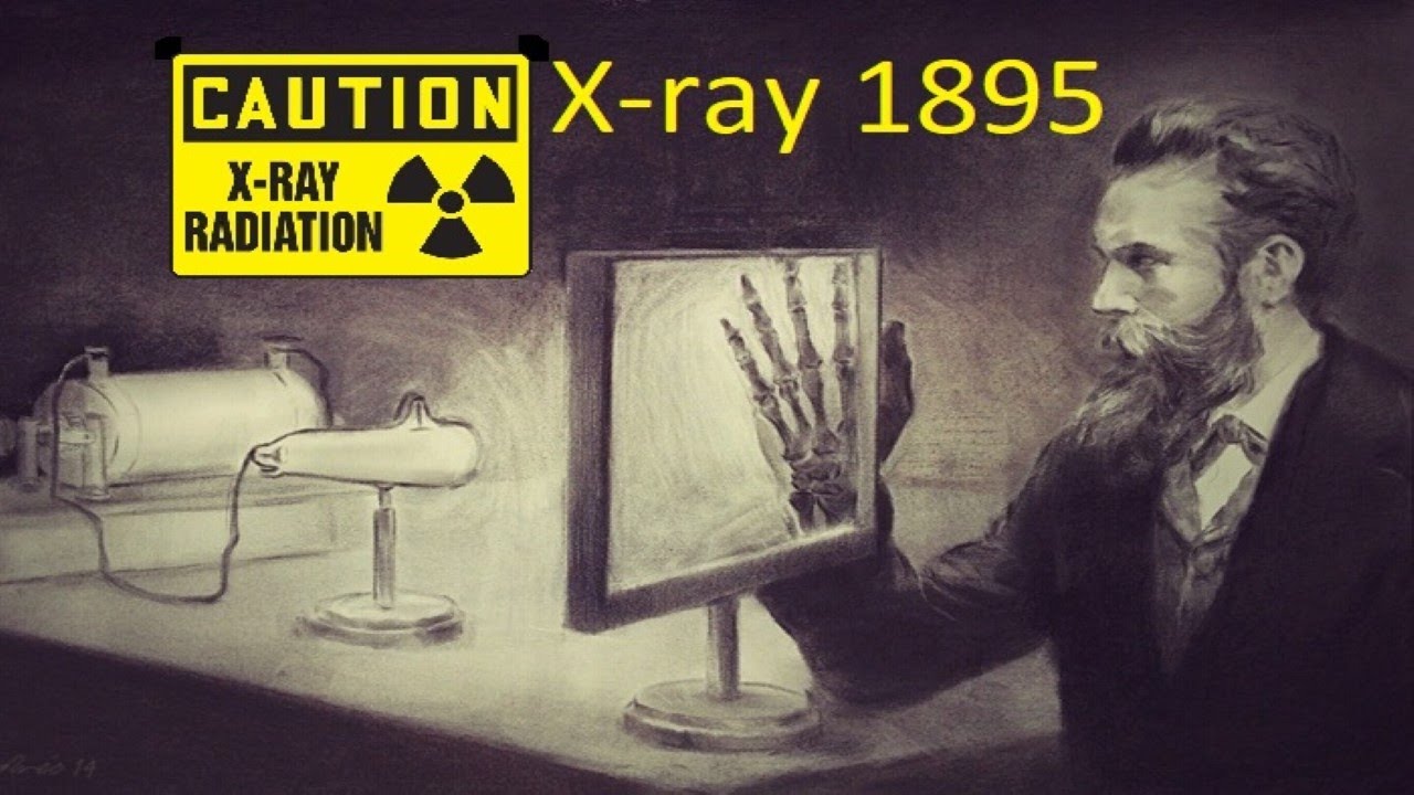 1895 Wilhelm R&ouml;ntgen History x-ray