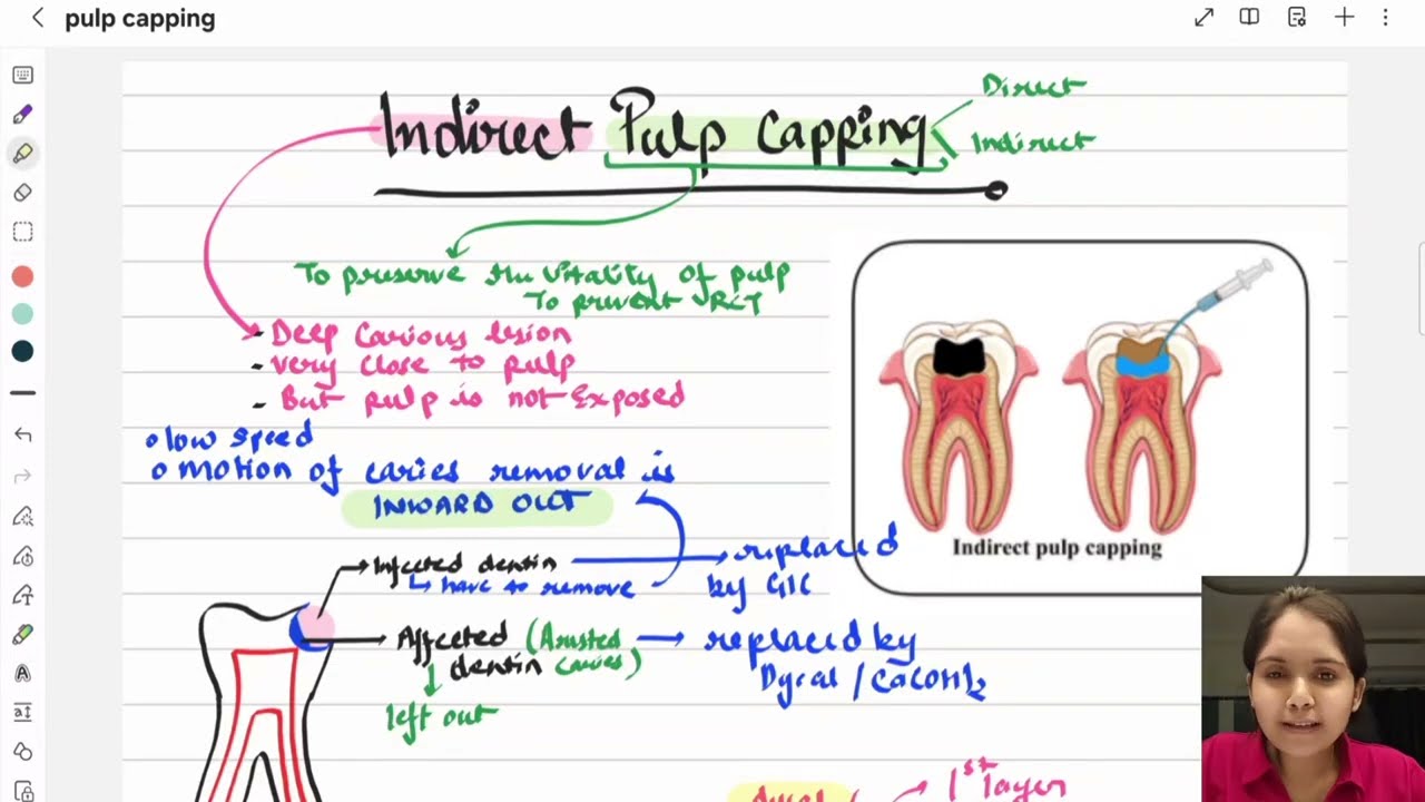 PULP CAPPING | ONE SHOT | Endodontics lecture | dental lectures | NEET MDS INICET 