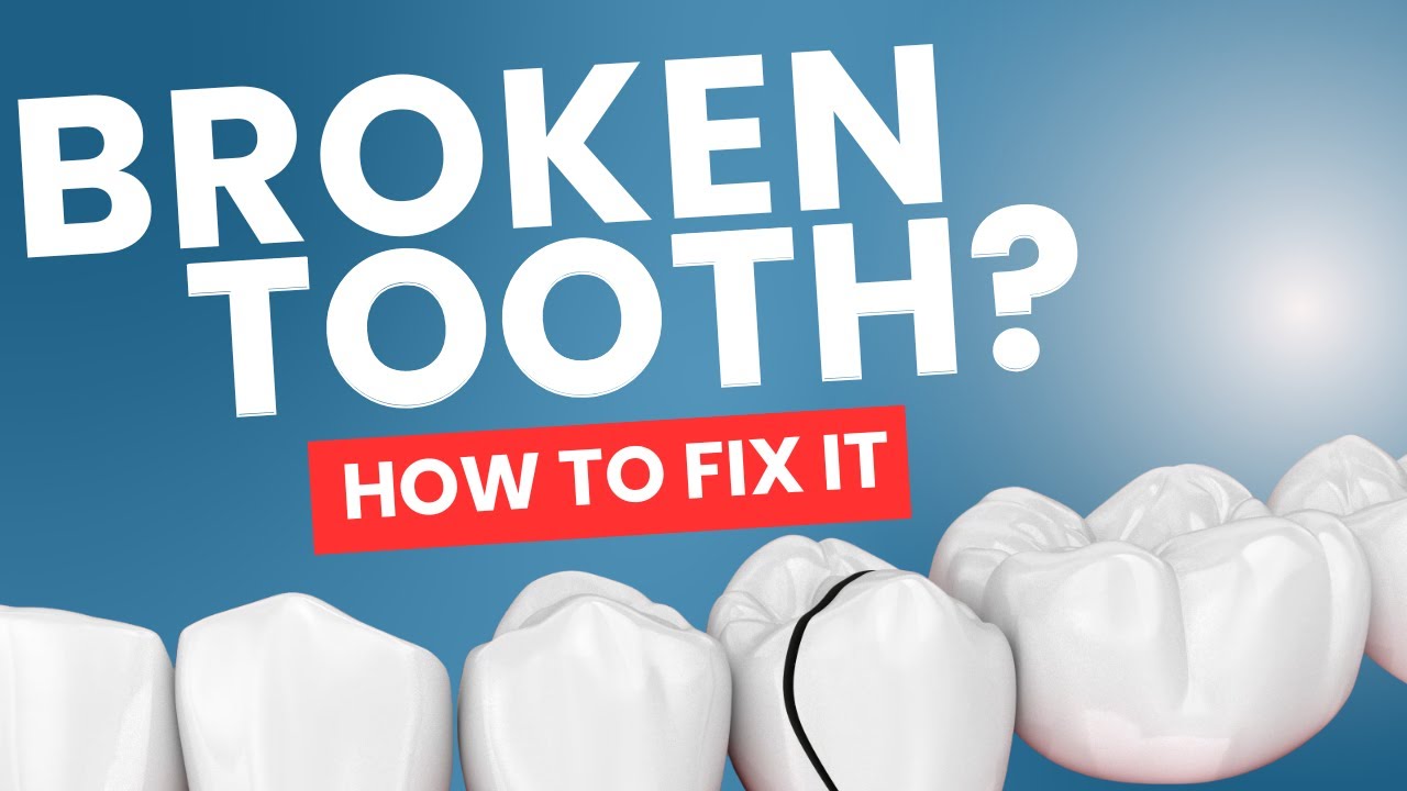 Tooth Trauma Explained: What Dentists Say Matters Most in the First 60 Minutes