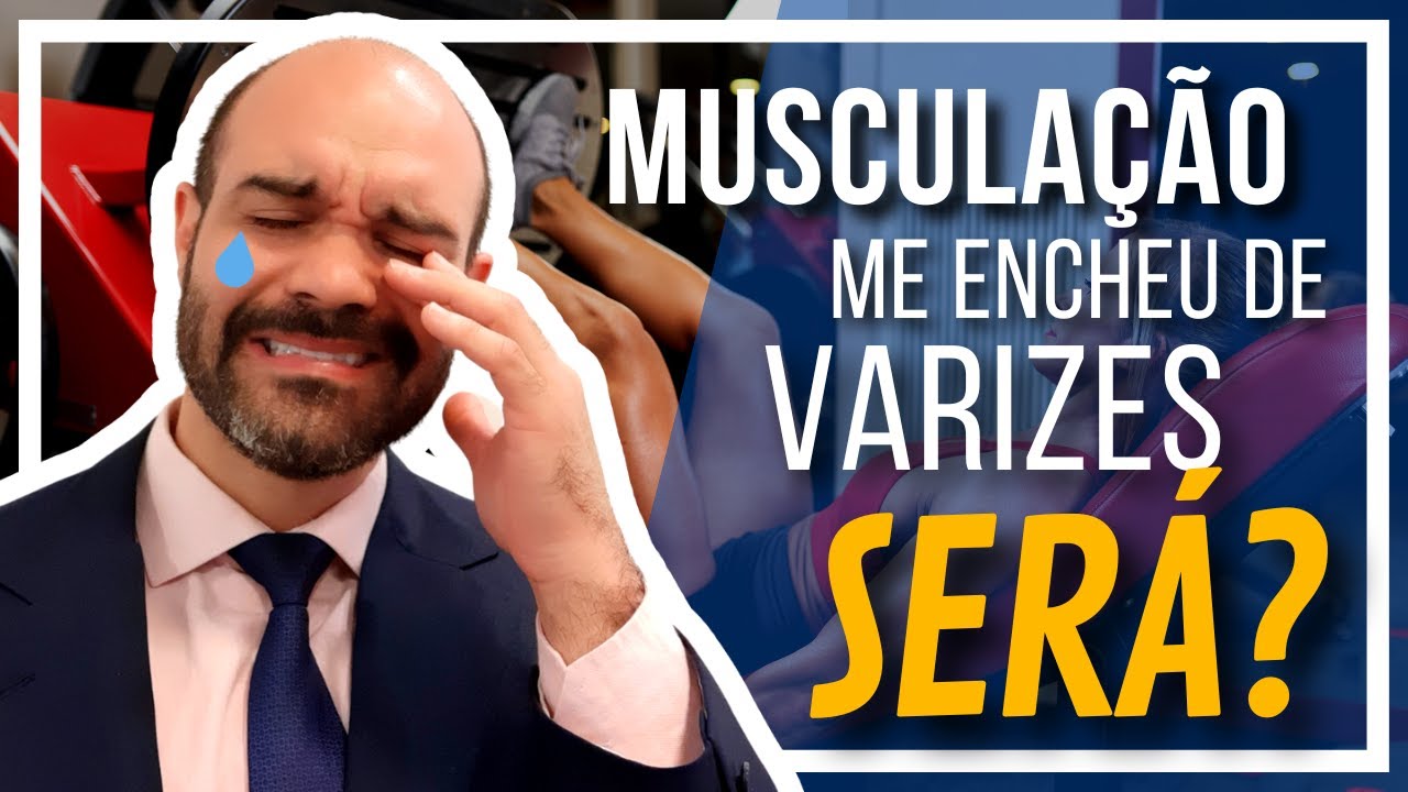 🔴 A Musculação realmente piorou suas Varizes? [Será mesmo?]