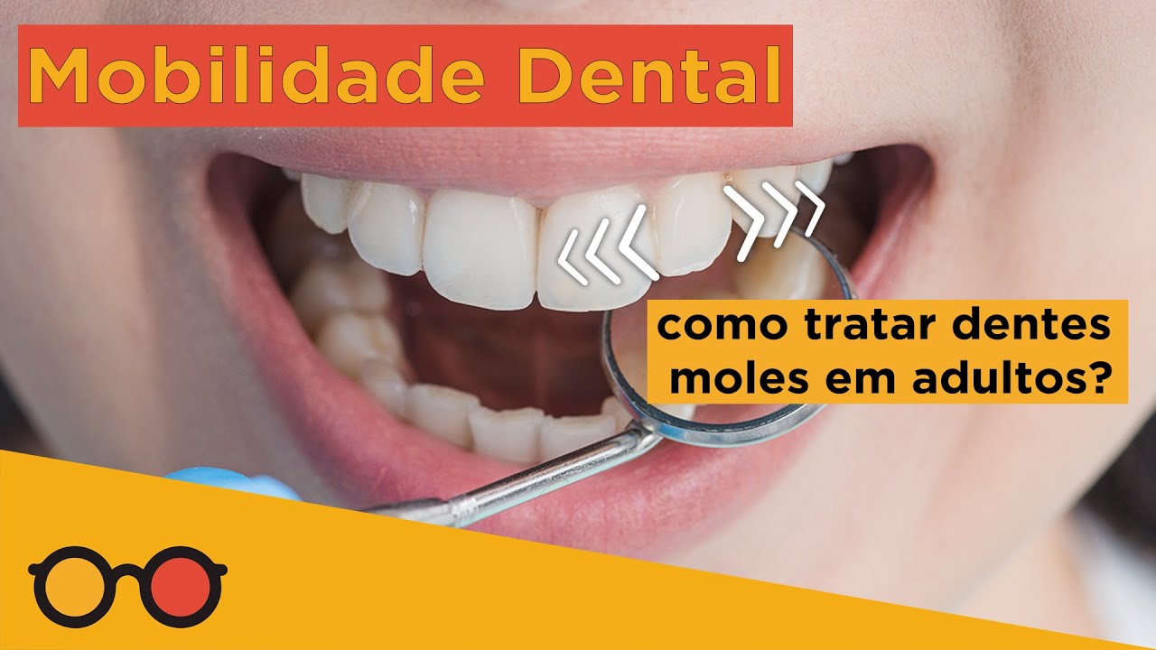 Mobilidade dental: como tratar dentes moles em adultos? - Plantão de Dúvidas