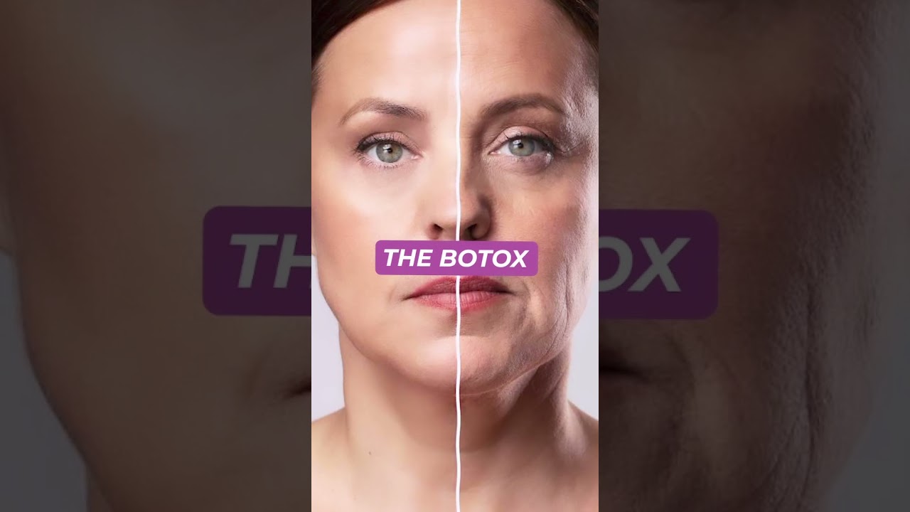 BEST Alternatives to Botox! 🕰️  ✨
