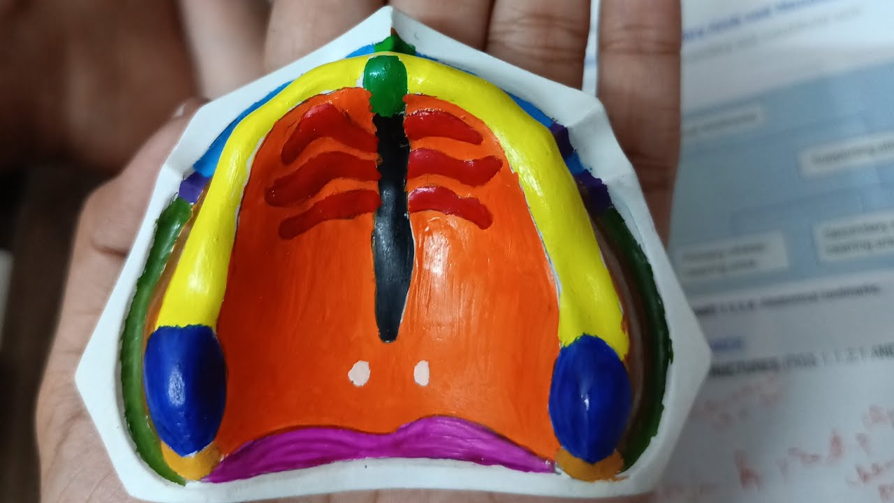 Anatomical Landmarks Maxilla Cast Painting | First year BDS practicals | Prosthodontics practical 🖌️