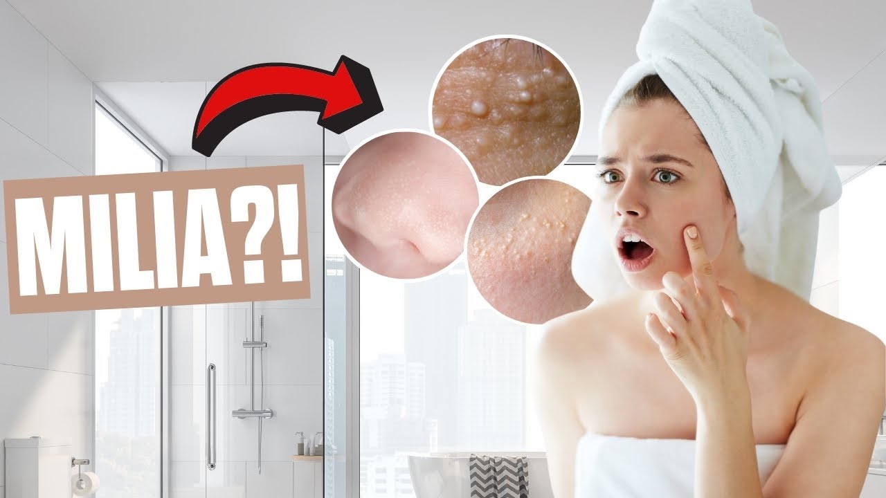 Hard White Bumps On The Face [Causes and How to Treat]