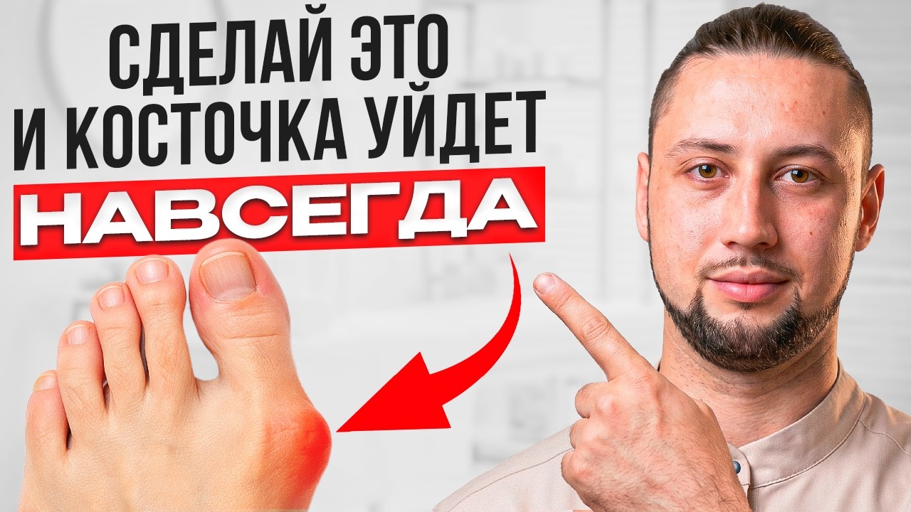 Косточка на стопе растёт из-за ЭТОГО! 90% людей не знают причину