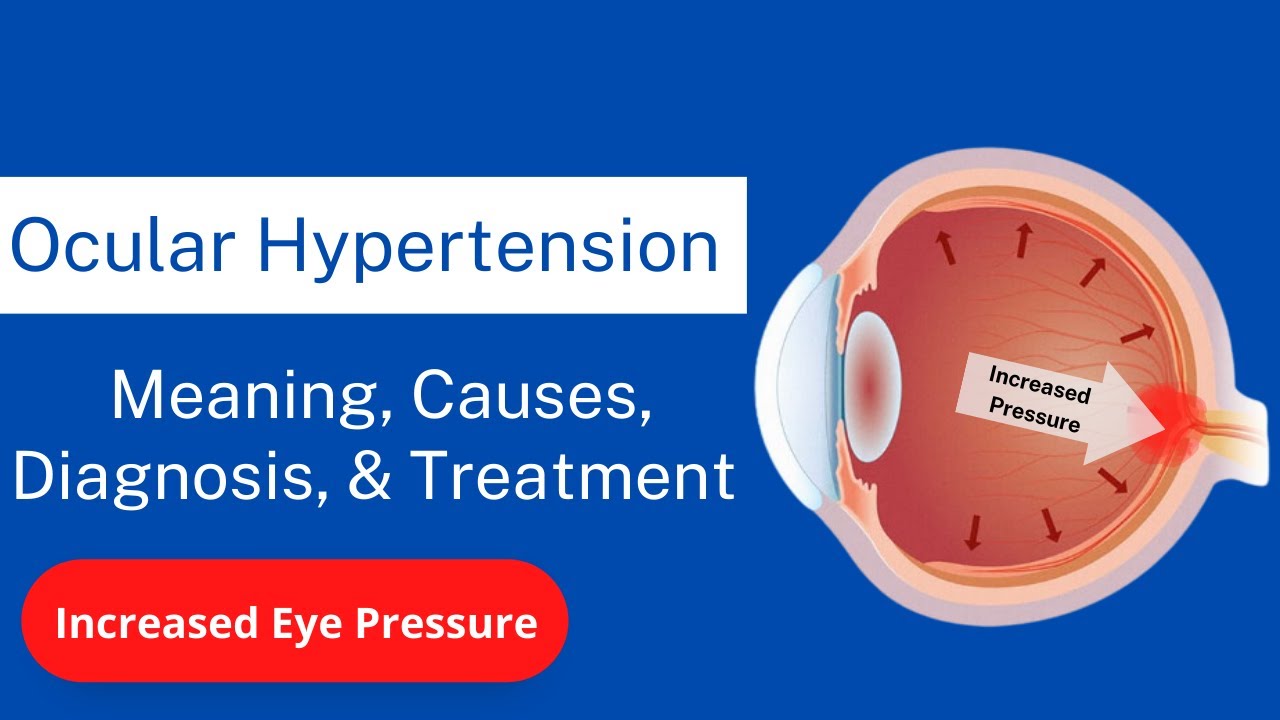 Ocular Hypertension: Meaning, Causes, Diagnosis, and Treatment | Hypertension in the Eye