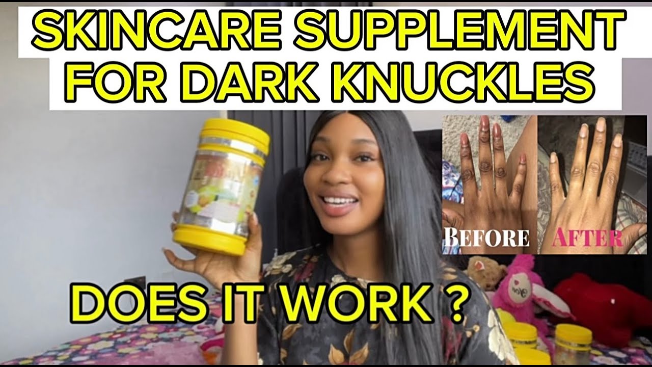 GET RID OF DARK KNUCKLES FAST | MY HONEST REVIEW ON LADIES SHINE SKINCARE SUPPLEMENTS