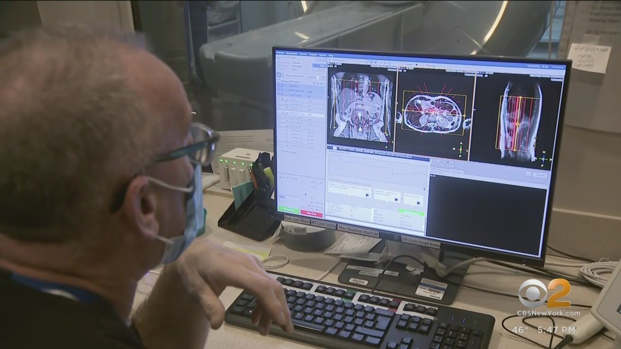 New Jersey hospital uses cutting-edge tech to screen pancreatic cysts