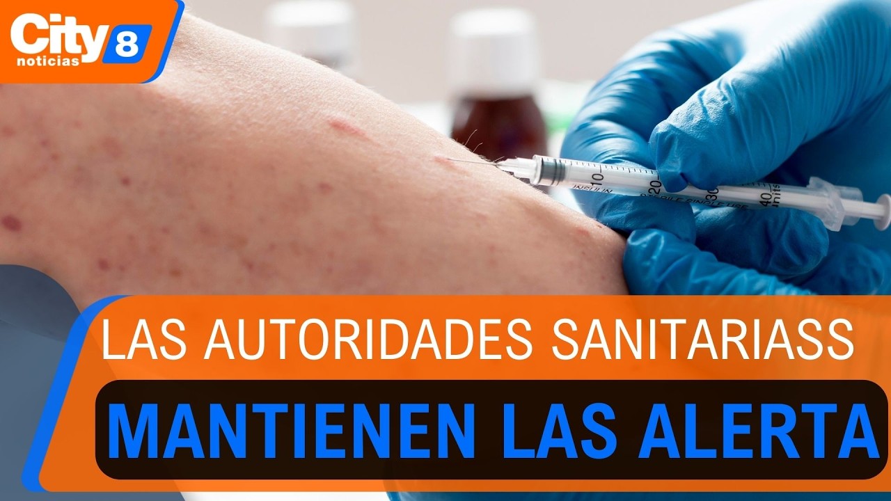 Sigue la vigilancia en Bogotá por el caso extranjero de sarampión | CityTv