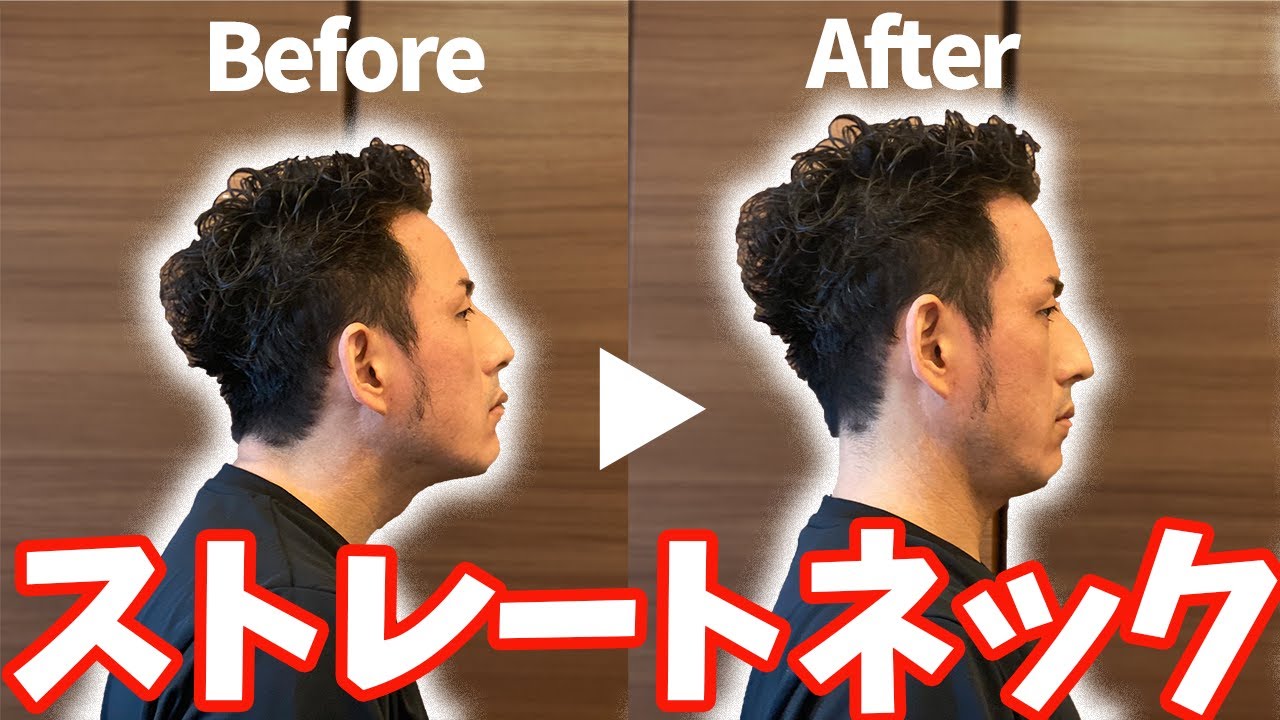 【ストレートネック】スマホ首、クレーンネックを解消する方法【大分市 腰痛治療家 GENRYU ( 安部元隆 )】