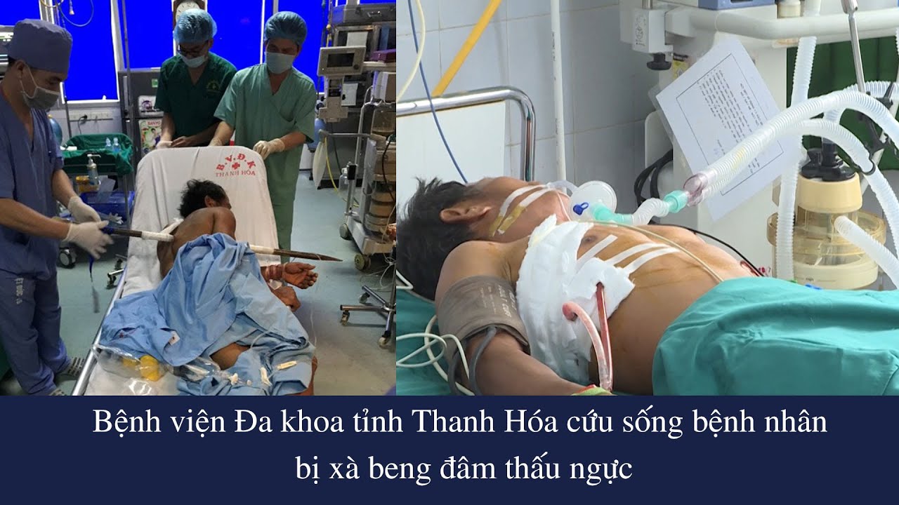 Bệnh viện Đa khoa tỉnh Thanh Hóa cứu sống bệnh nhân bị xà beng đâm thấu ngực | PTTH Thanh Hóa