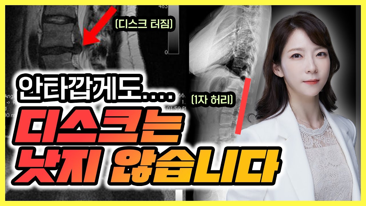 허리디스크 정말 완치 가능?  병원 가지 않으려면 꼭 시청 필수 !
