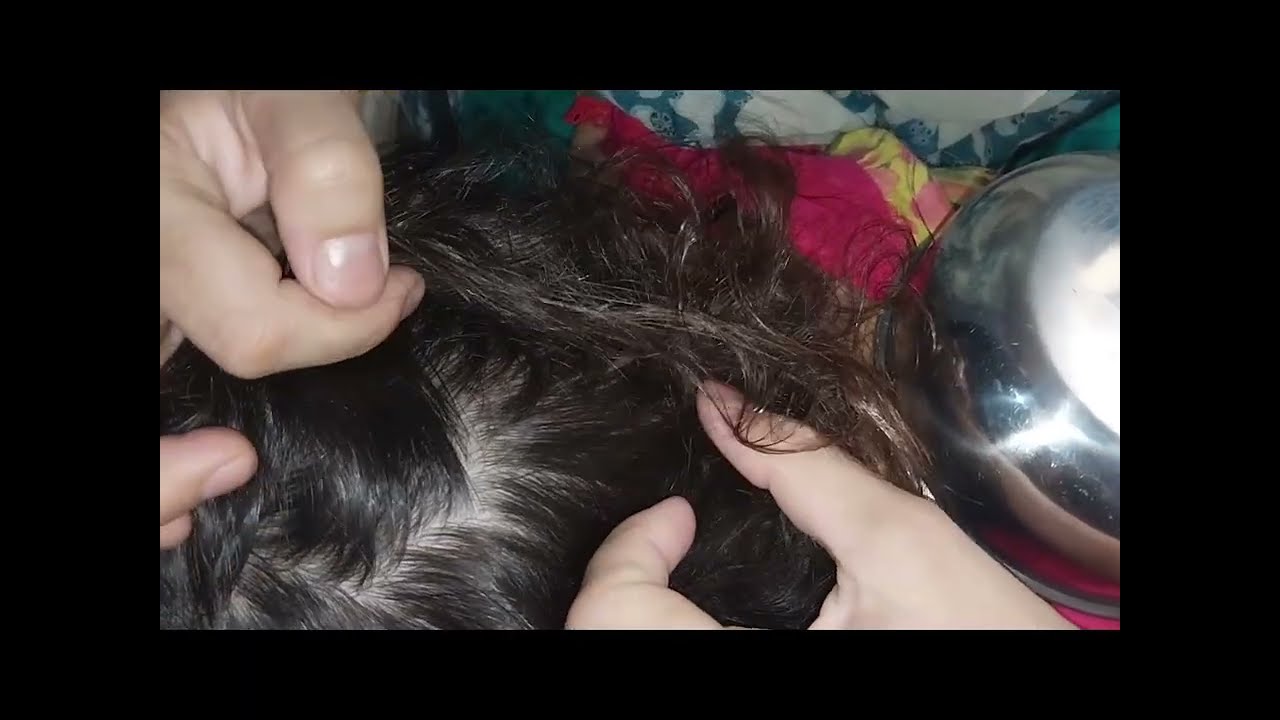 Nitpicking ASMR video 304    #nitpicking #asmr #kuto #piolhos #petantumo #licepicking #catandopiolho