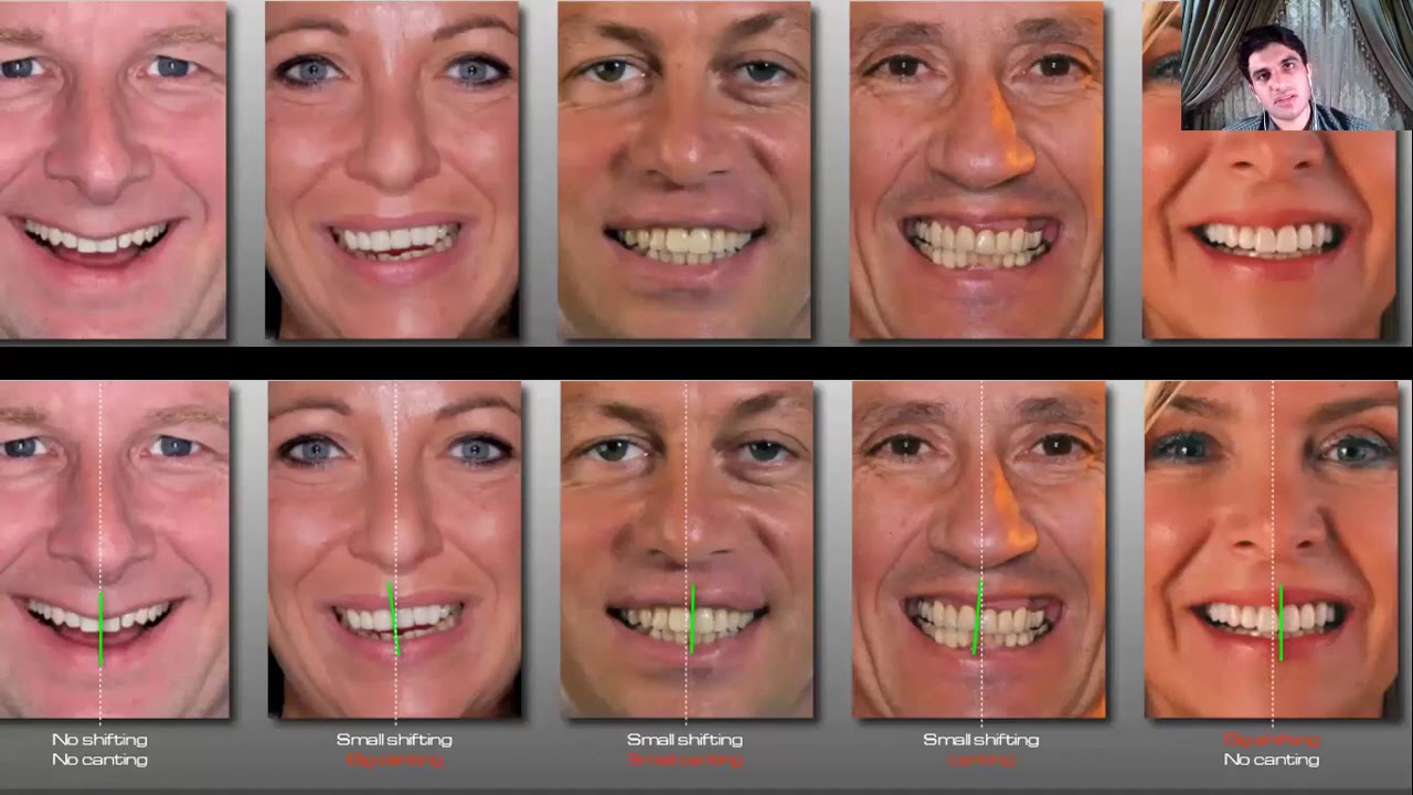 Digital smile design( DSD)