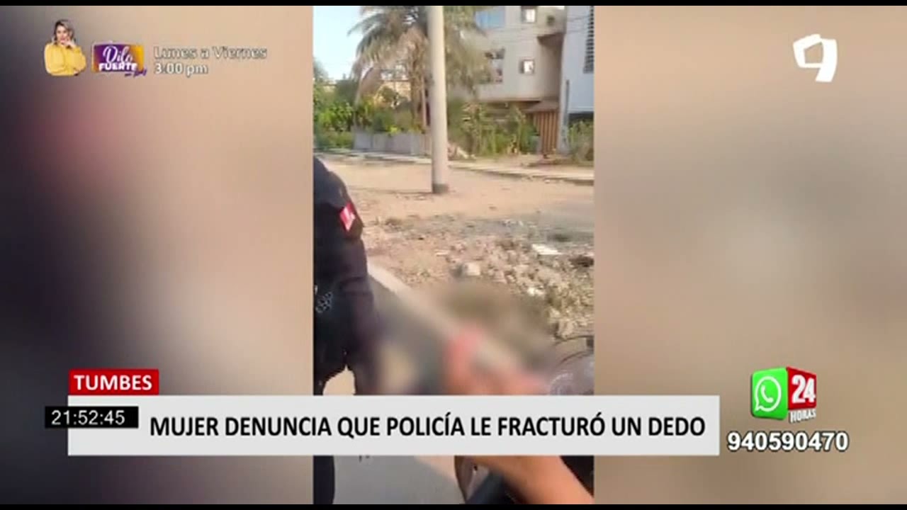 Tumbes: mujer denuncia que policía le rompió el dedo durante intervención (2/2)