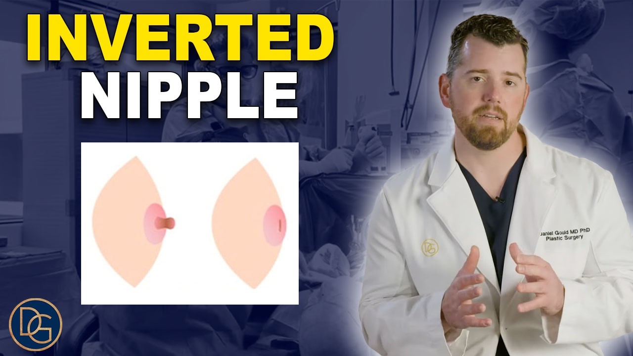 Inverted Nipple Repair IGTV