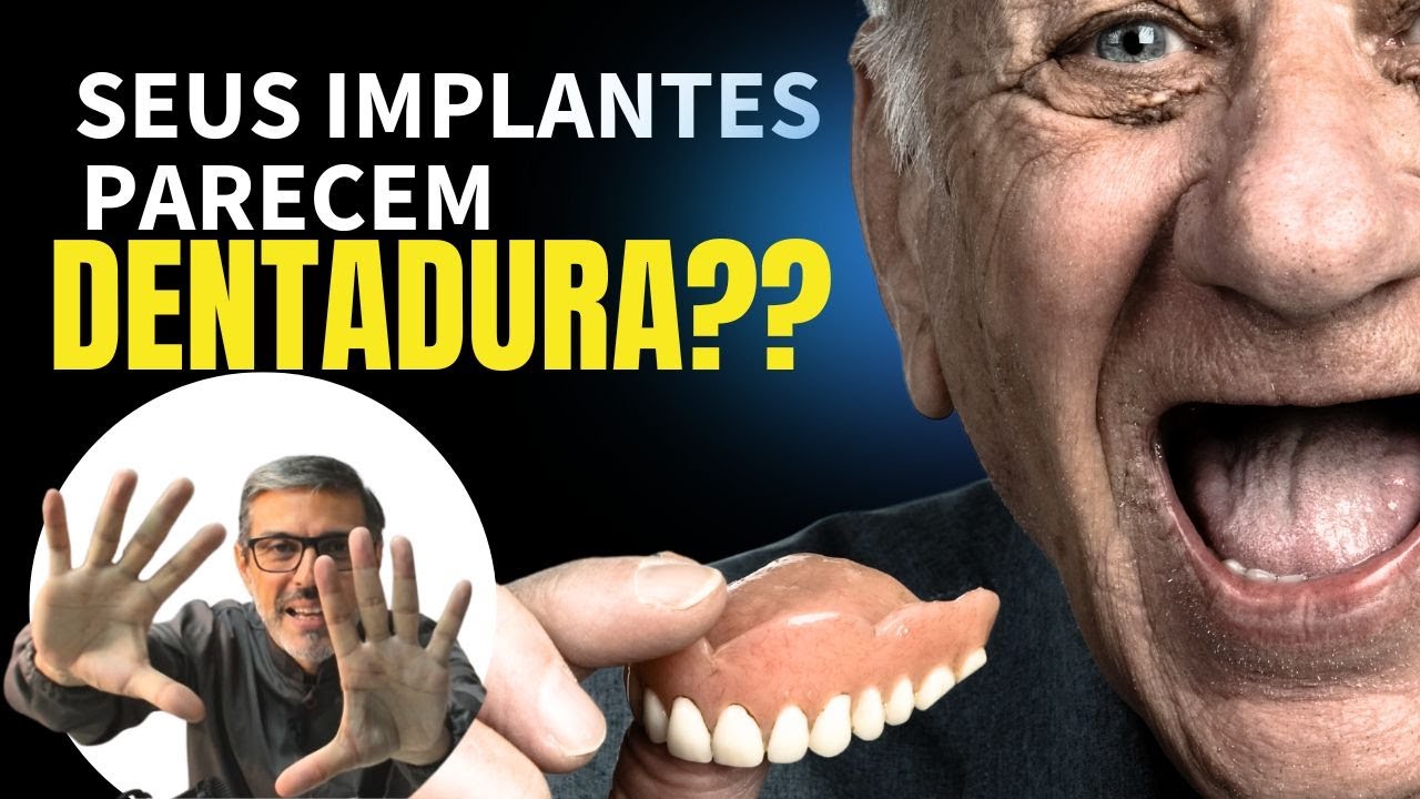 Sua Prótese Com Implantes Vai Parecer uma Dentadura?