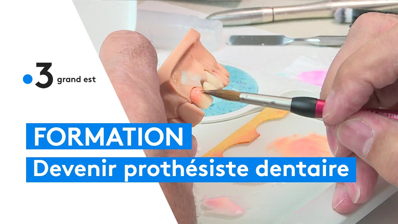 Les apprentis proth&eacute;sistes dentaires de Metz visent l'excellence