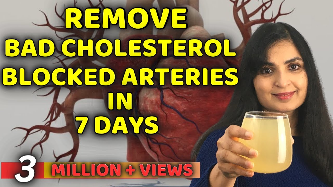 Doctors Won&rsquo;t Tell You This! Remove Bad Cholesterol Naturally & Reduce Clogged Arteries