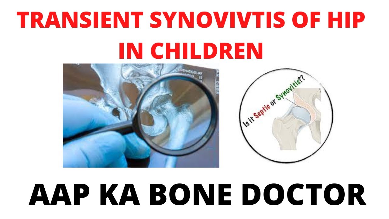 TRANSIENT SYNOVITIS OF HIP in children - EPISODE 54