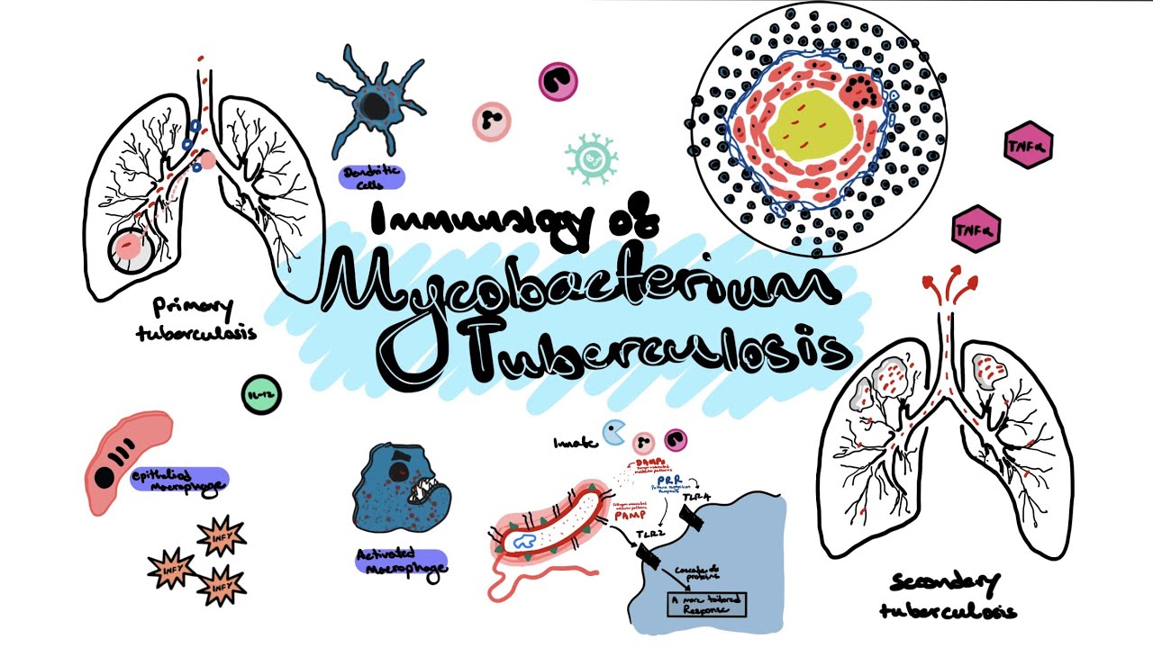 Mycobacterium Tuberculosis (TB) Immunology [Immunology basics, granuloma formation, TB reactivation]