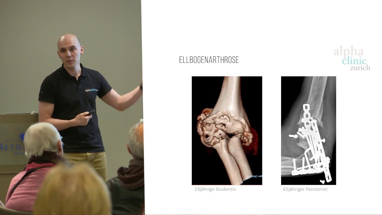 Arthrose des Ellbogens