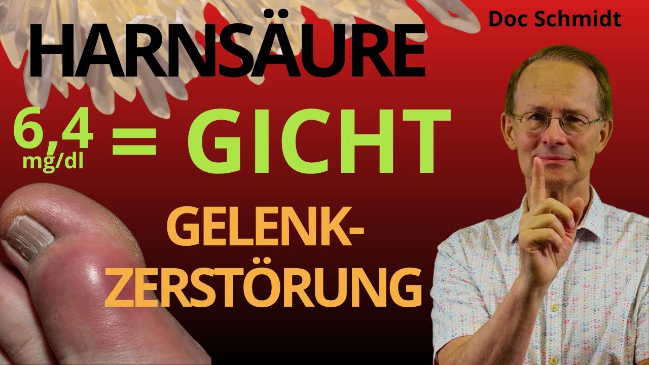 Harnsäure zu hoch = Gicht . Keiner reagiert ! Was nun? Unser Antigichtprogramm aus der Praxis.