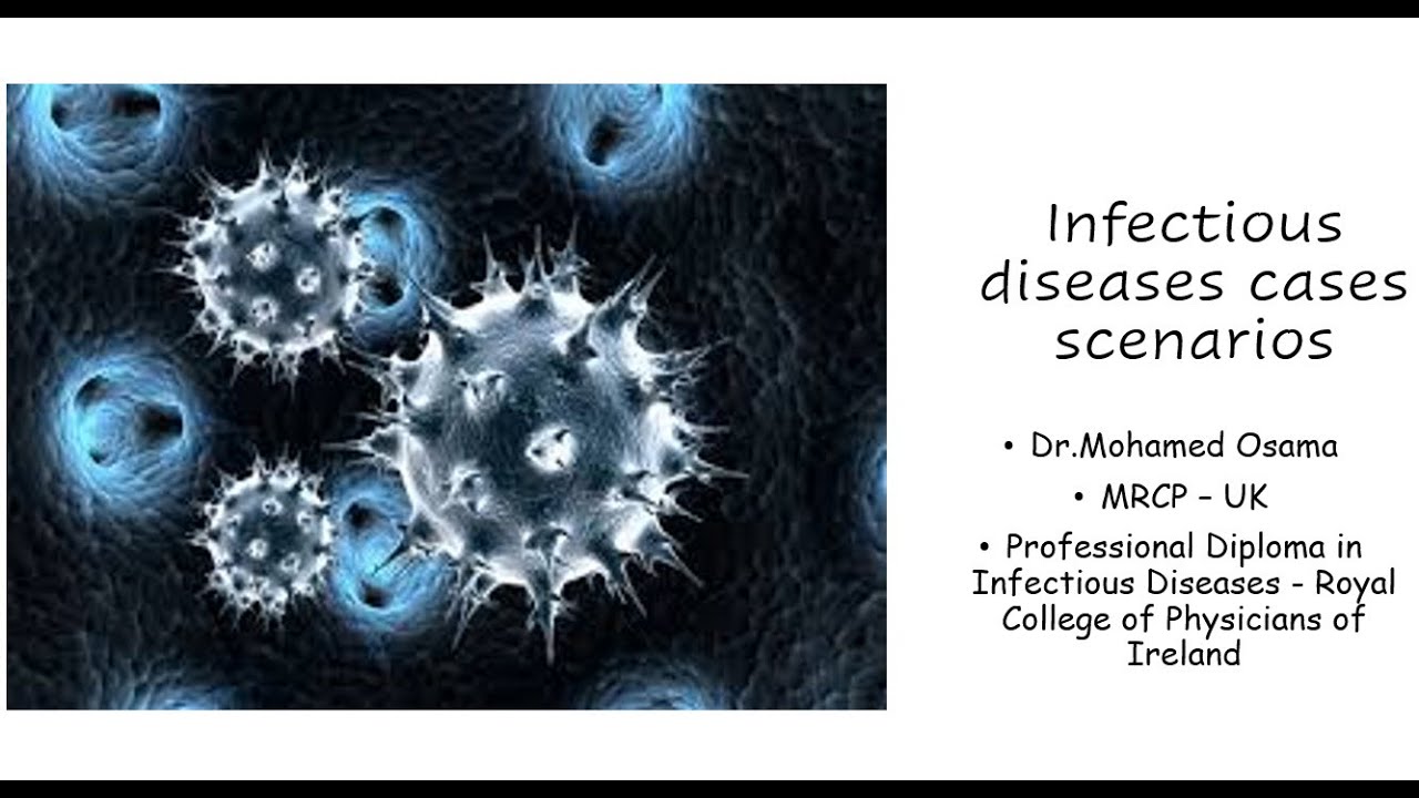 Interesting  infectious diseases case scenarios for MRCP - Dr.Mohamed Osama