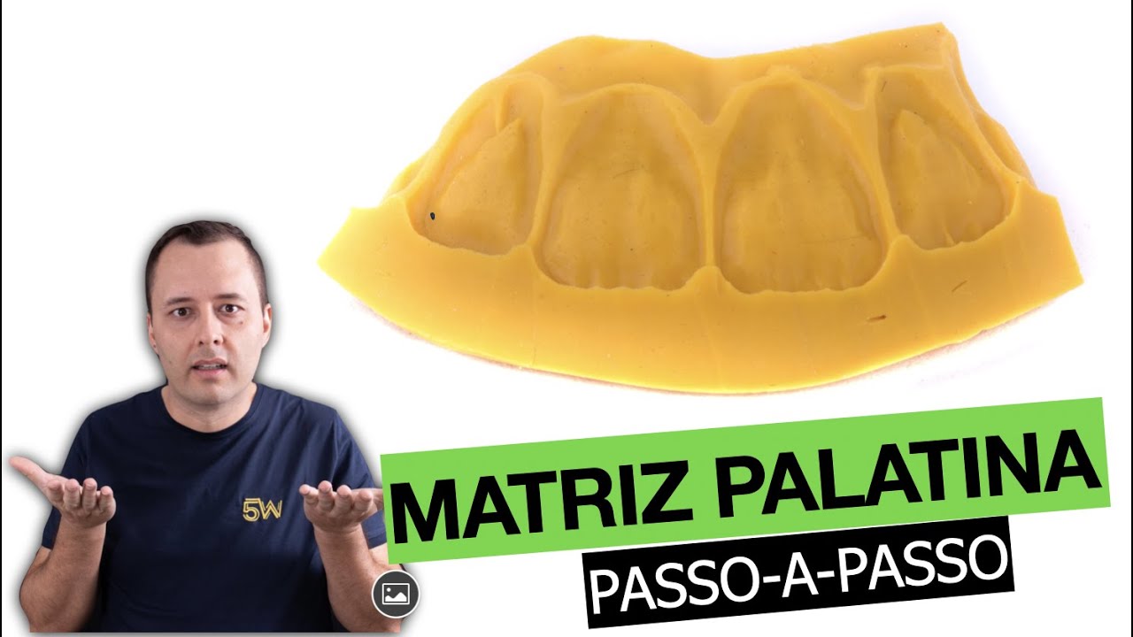 Como fazer uma matriz de silicone para resinas anteriores.