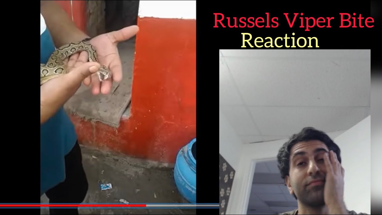 Russels Viper BITE | Reaction/Discussion