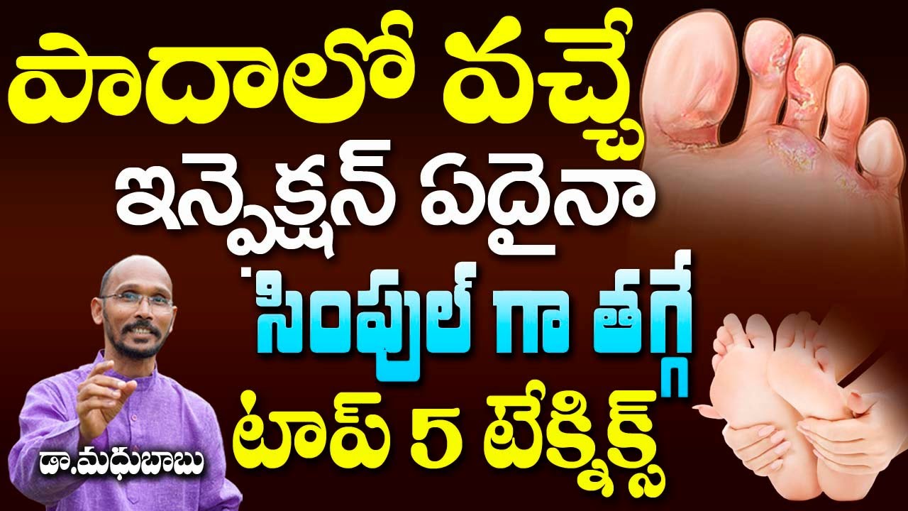 పాదాల్లో వచ్చే ఇన్ఫెక్షన్ ఏదైనా సింపుల్ గా తగ్గే టాప్ 5  టెక్నిక్స్ | Dr. Madhubabu | Health Trends|