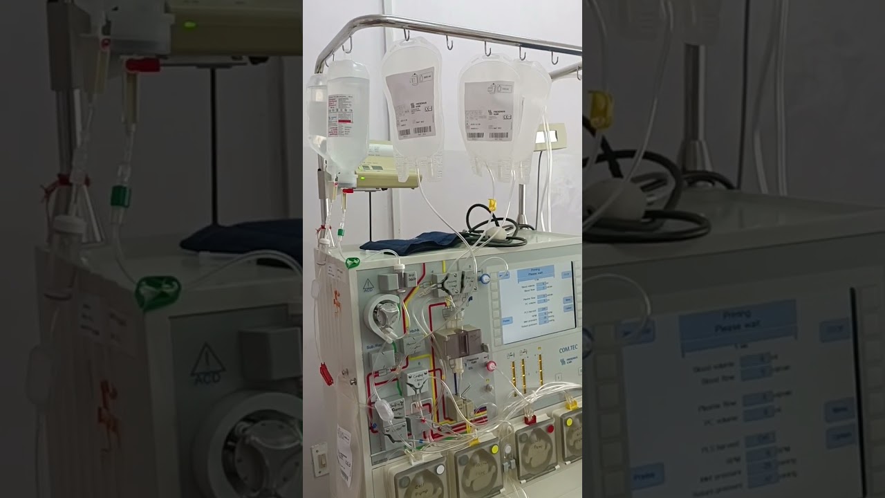 SDPA - Single donar platelet Apheresis.. procedure