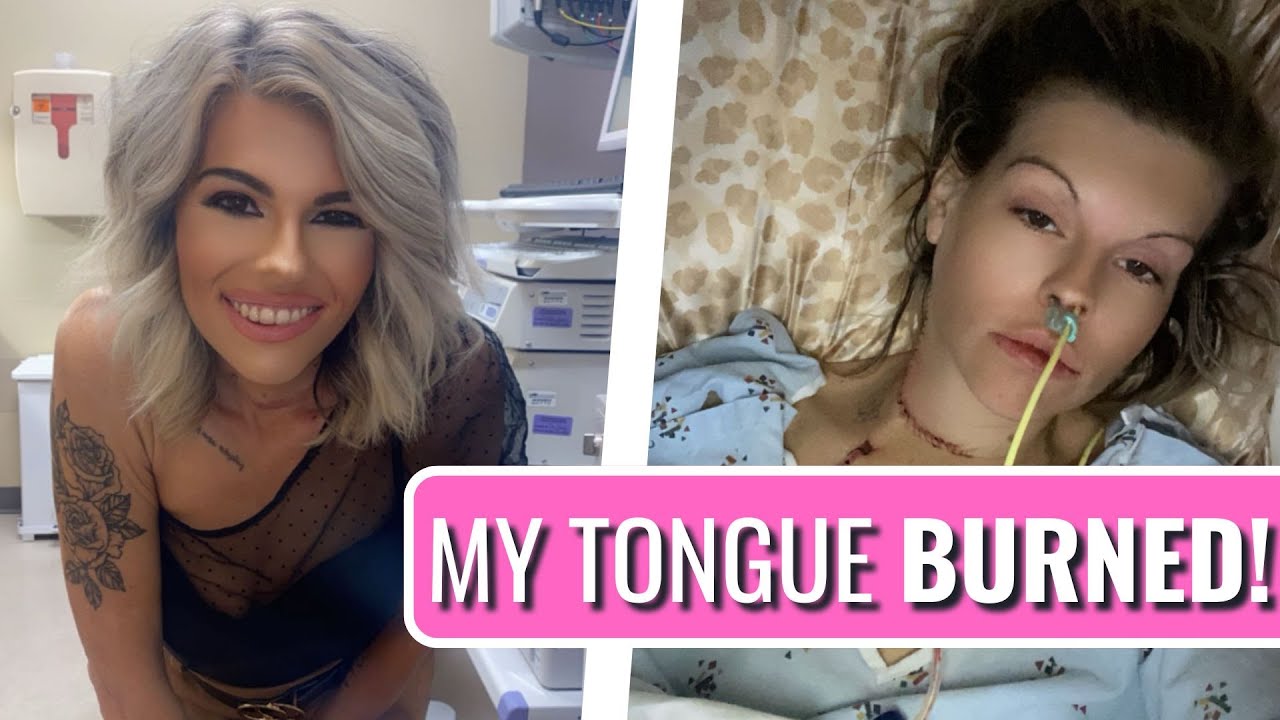 I Found a MASSIVE Lump in My Mouth! - Kandi | Adenoid Cystic Carcinoma | The Patient Story