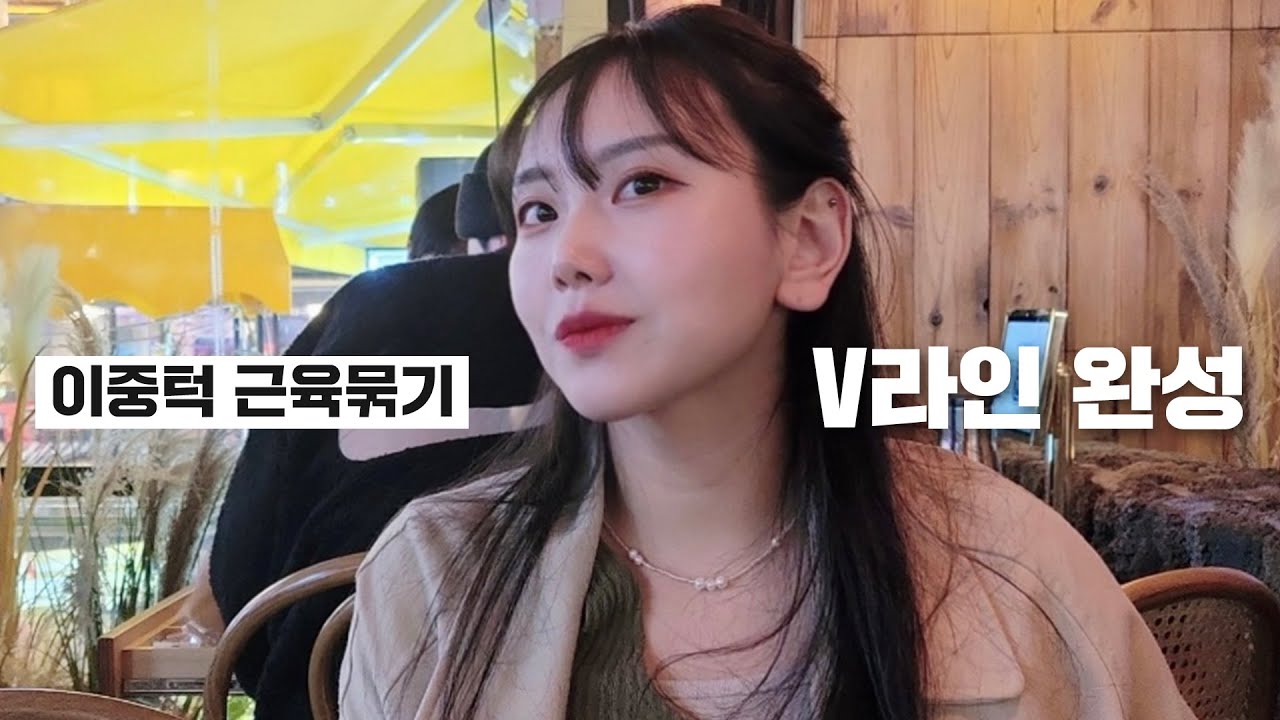 이중턱근육묶기 10일차 리얼후기
