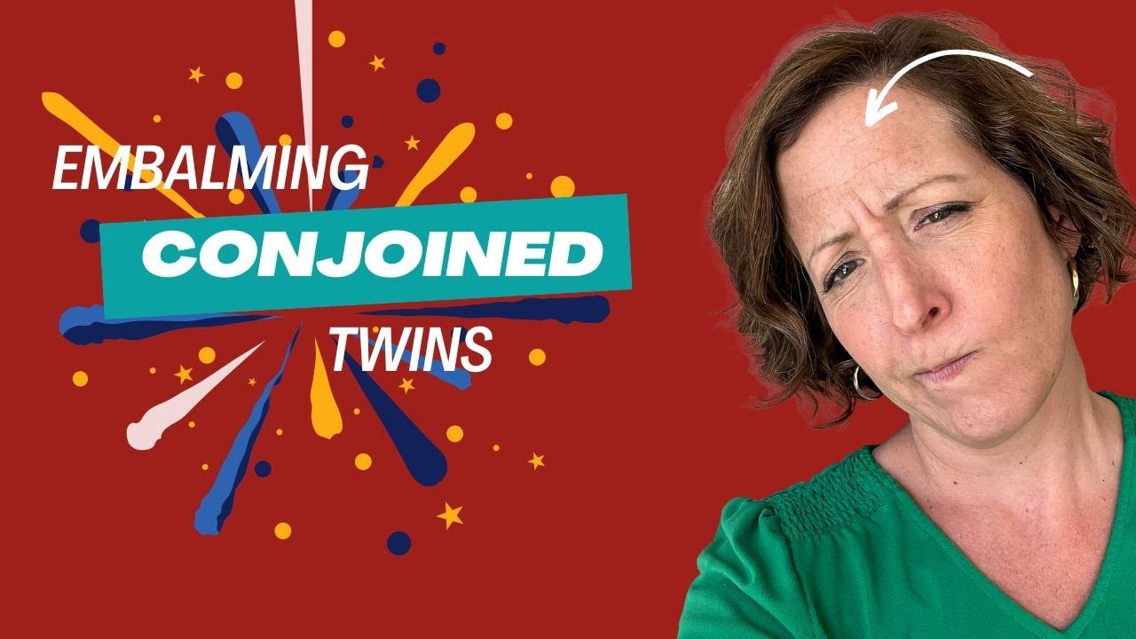 Live with a Mortician Let's Chat About Embalming Conjoined Twins