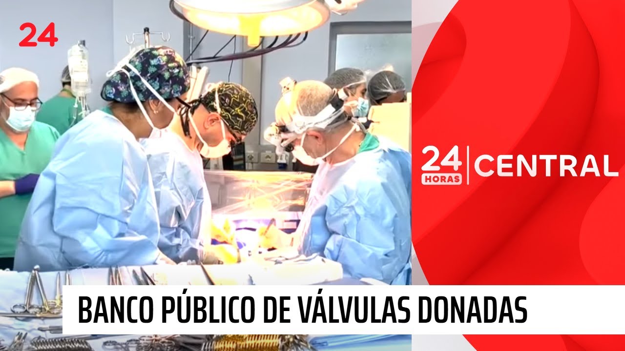 Inauguran primer banco público de válvulas donadas | 24 Horas TVN Chile