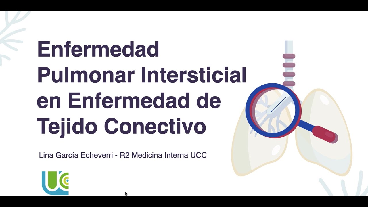 Enfermedad Pulmonar intersticial en enfermedades autoinmunes
