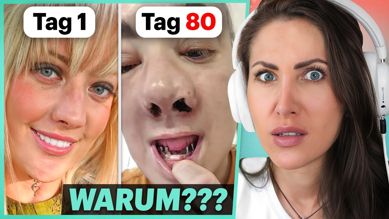 Die Langzeitfolgen von Turkey Teeth...