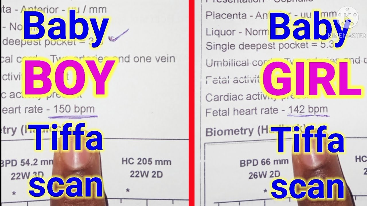 Baby boy and baby girl tiffa scan reports ||tiffa scan reports in telugu