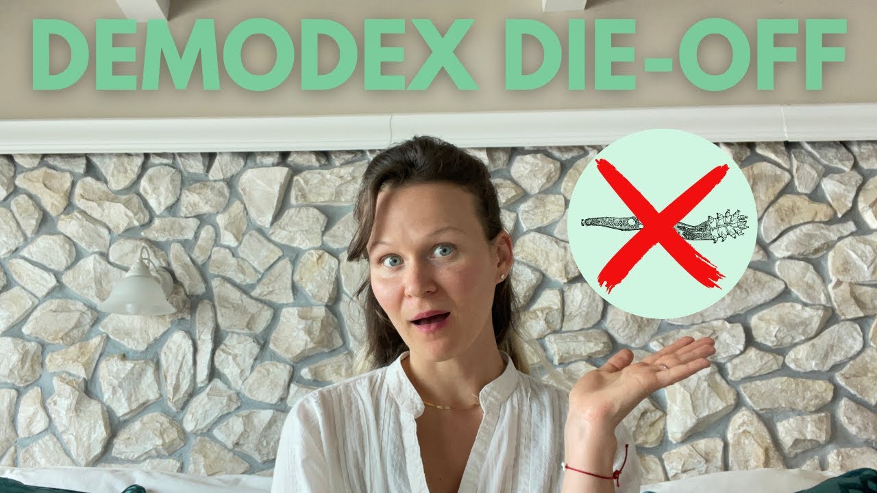 WHY are my DEMODEX Symptoms getting WORSE?