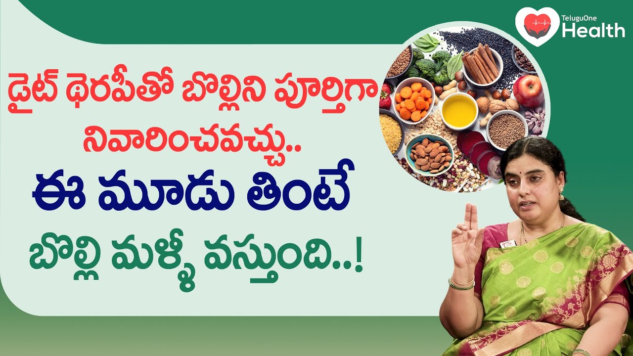 Bolli Diet Therapy | డైట్ థెరపీతో బొల్లిని పూర్తిగా నివారించవచ్చు.. Dr. SGV Sathya | TeluguOneHealth