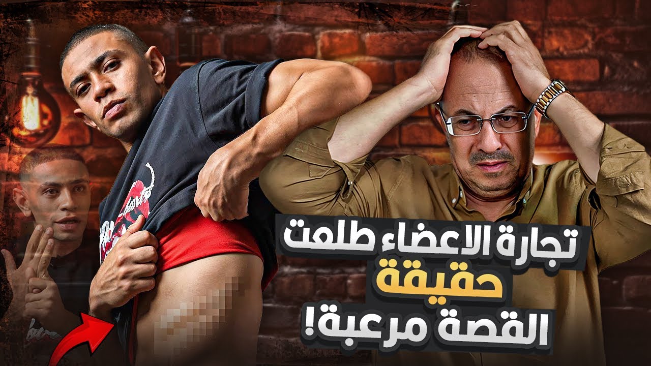 بيع وتجارة الاعـ ـضـ ـاء للاسف طلع الموضوع حقيقى | شاب بيحكى تجربته ازاى باع كليته ب100 الف جنيه !!