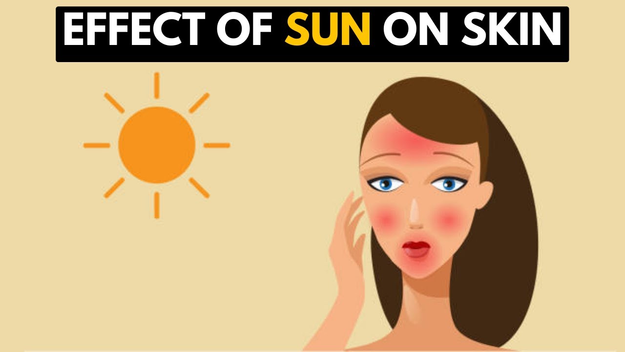 The Effect of the Sun on the Skin.