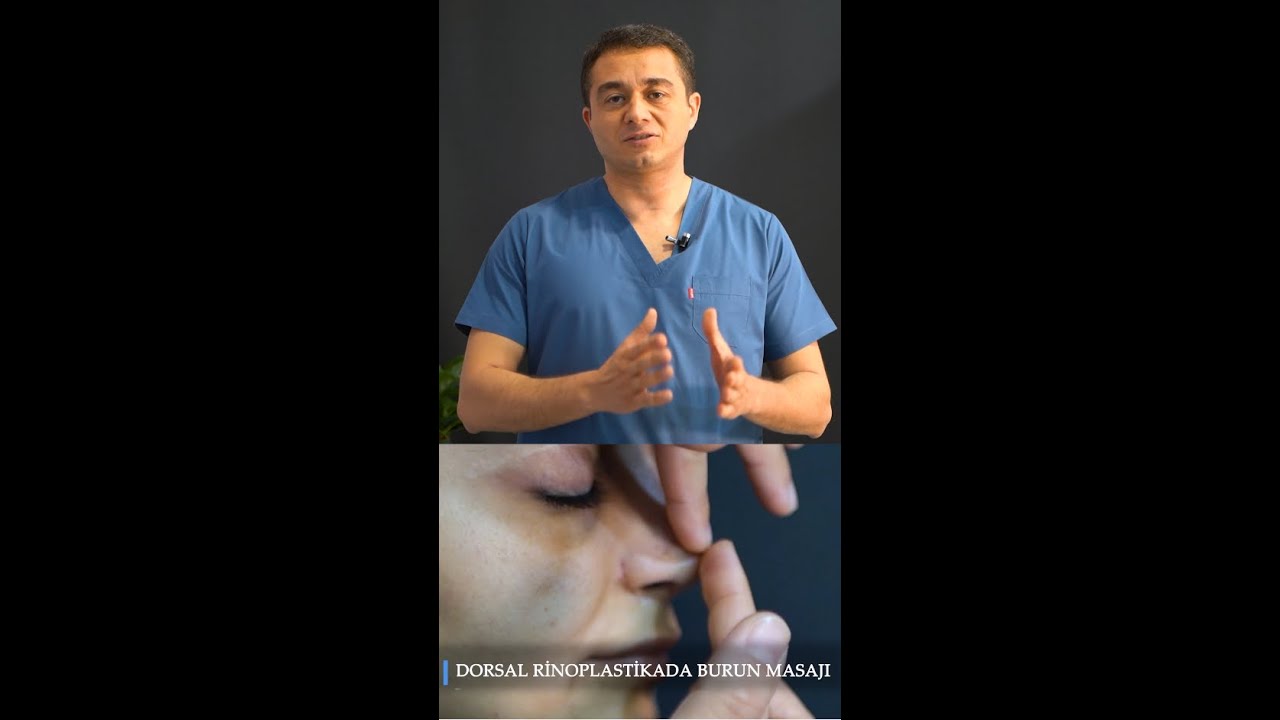 BURUN MASAJI. Dorsal Rinoplastika əməliyyatından sonra necə masaj olunmalıdır. Dr. Xaliq Şıxəliyev