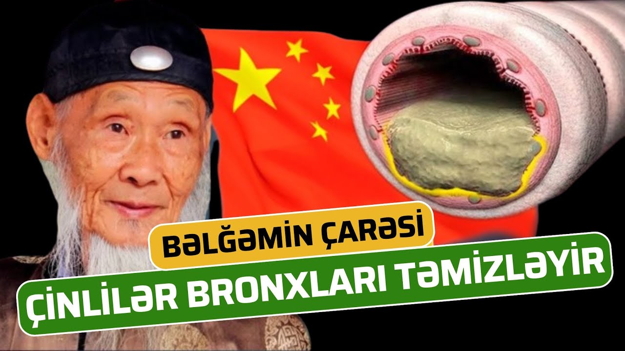 Çinlilər Boğaz və Bronxlardakı BƏLĞƏMİ belə Təmizləyir