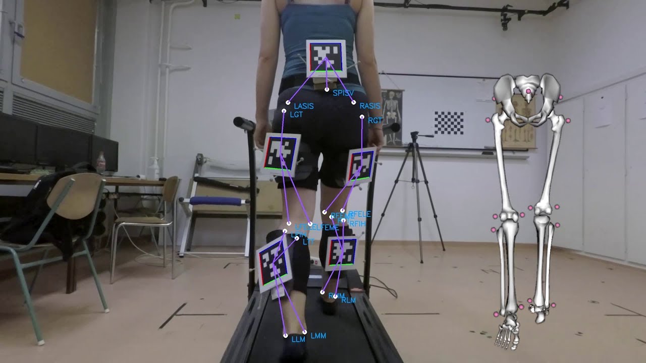 Affordable gait analysis using augmented reality markers