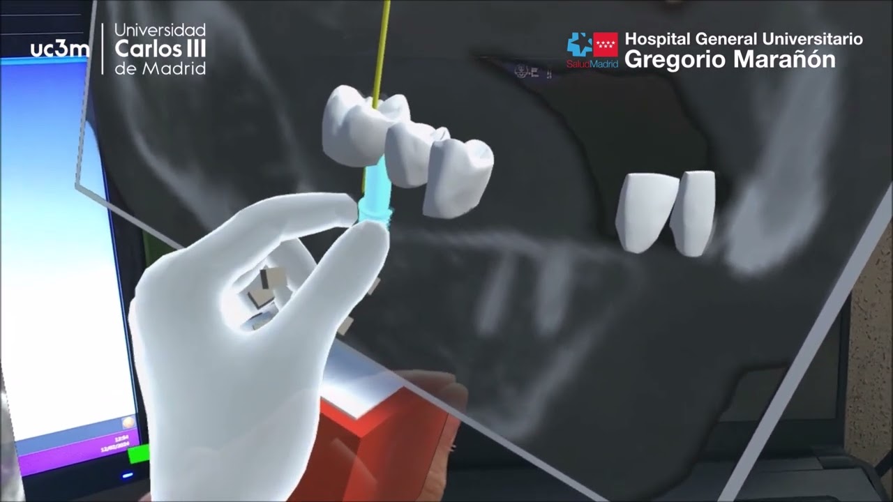 Augmented Reality application on Microsoft HoloLens 2 for Planning Dental Implants Placement